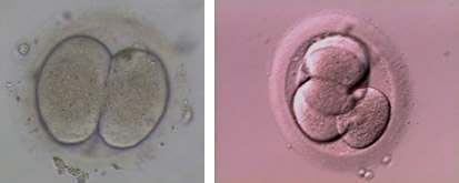 2 Cell and 4 Cell Embryo