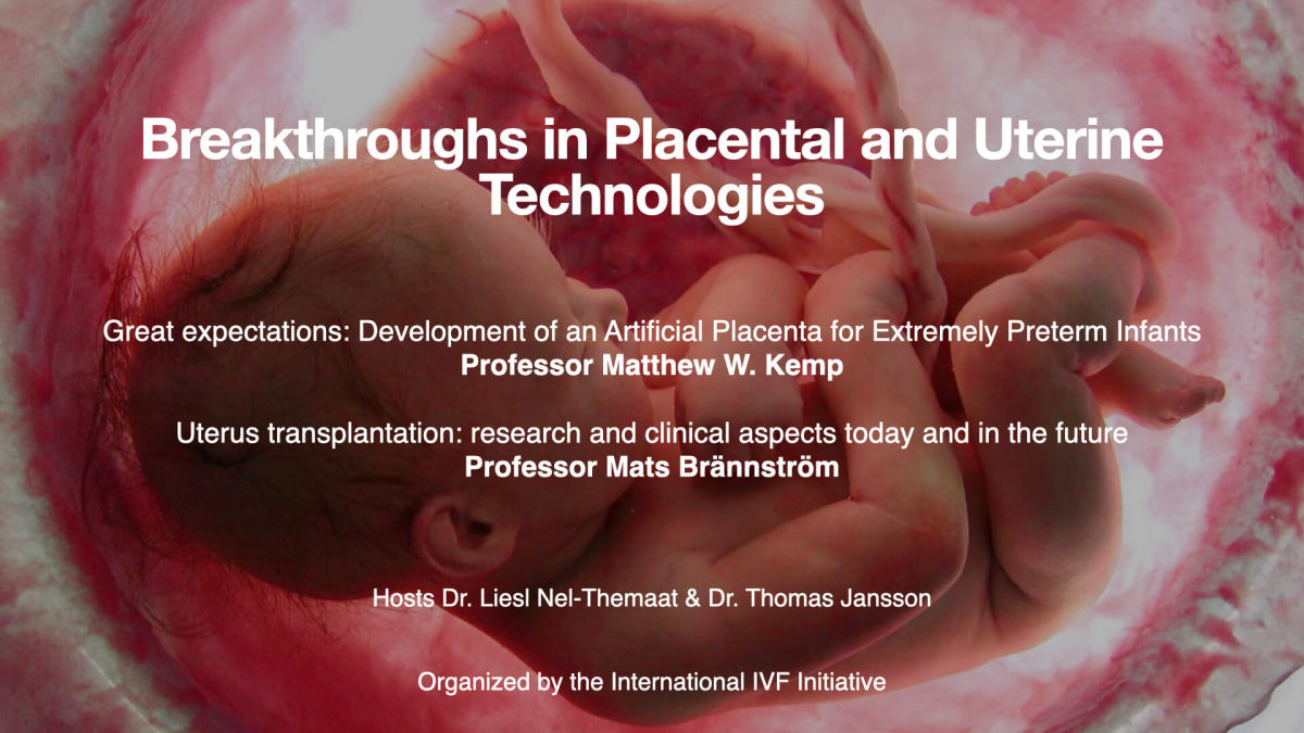 Session 18 - Breakthroughs in Placental and Uterine Technologies 