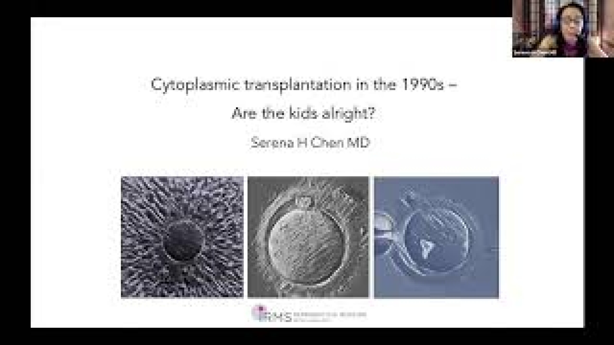 Cytoplasmic transplantation in the 1990s - Are the kids alright?