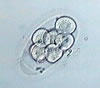 Oval shape embryo
