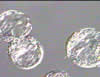 Hatching blastocyst