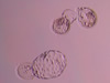 Fully hatched blastocyst