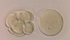 Embryo Conjoined with Oocyte