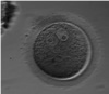 Two GVs in One Prophase I Egg