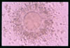 Metaphase II Oocyte