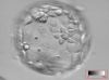 blastocyst with flower inside
