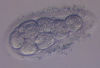 Embryo with Oval Shape