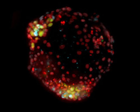 MERLN Pioneers New Approach for Studying Monozygotic Twin Formation