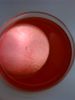 Fat Molecule-Found during Egg Pick Up-In Follicular Fluid