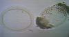 Fragile Oocyte 