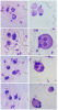 Difference between WBC and Spermatids