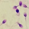 Simple Diff-Quik stain for chromatin integrity including DNA fragmentation.