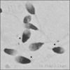 DNA Damage in Sperm Toroids revealed by Triton X-100 and DTT Pre-treatment before Staining.